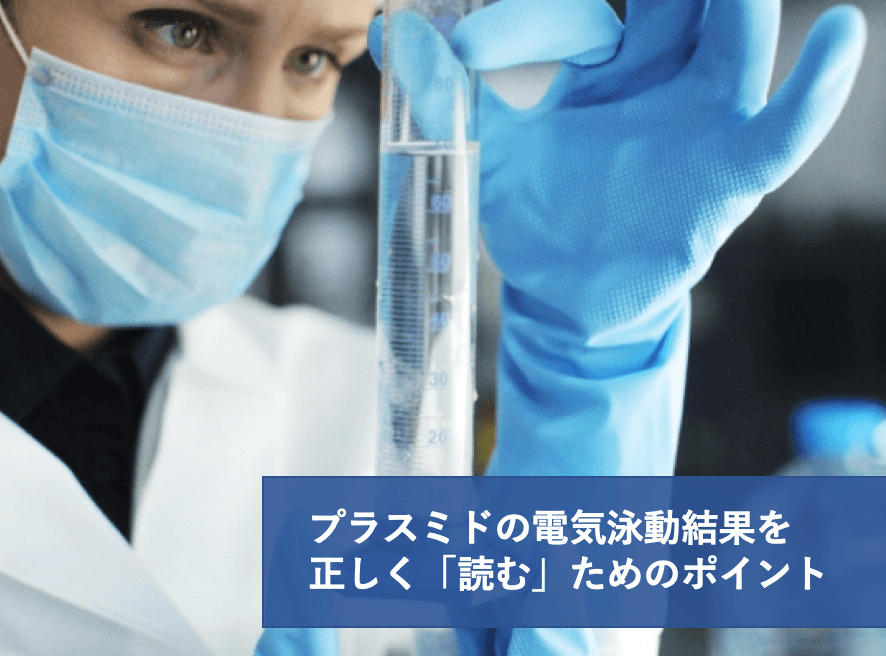 実験レシピ プラスミドDNAの電気泳動3/3 (結果を正しく「読む」ためのポイント) | リケラボ