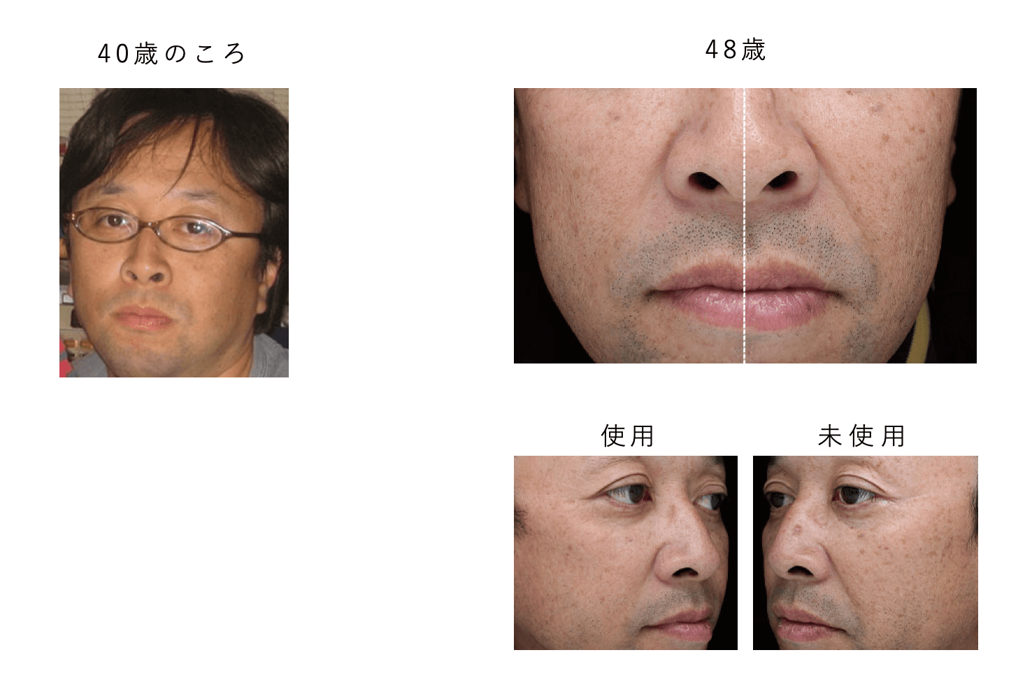 メディカルセラム リンクルアップ シワ取り 美容液